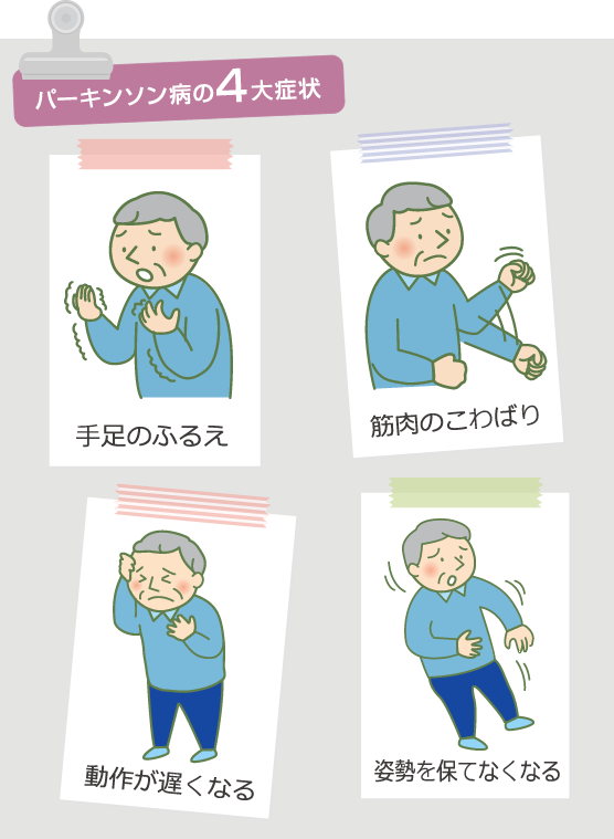 パーキンソン病４大症状　手足のふるえ　筋肉のこわばり　動作が遅くなる　姿勢を保てなくなる